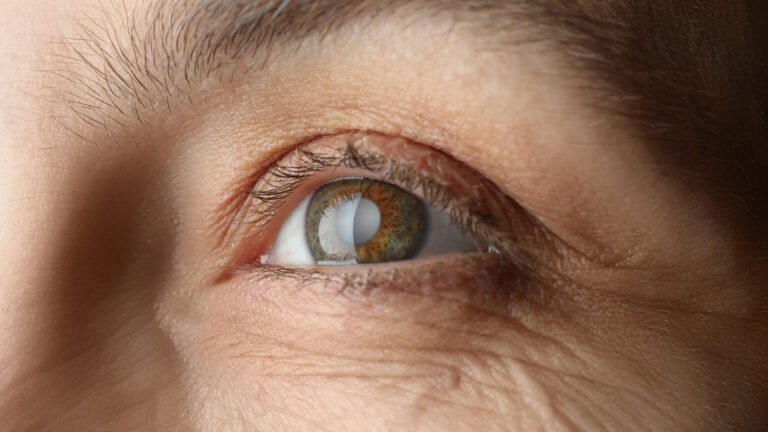 best country for cataract surgery